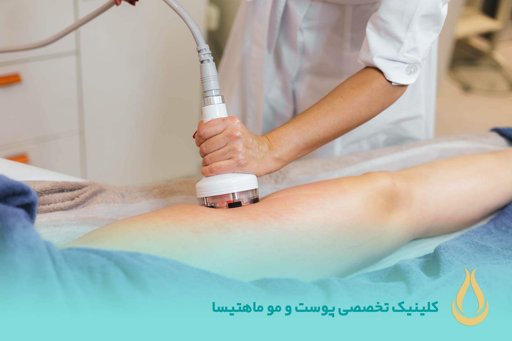 لیزر لاغری موضعی