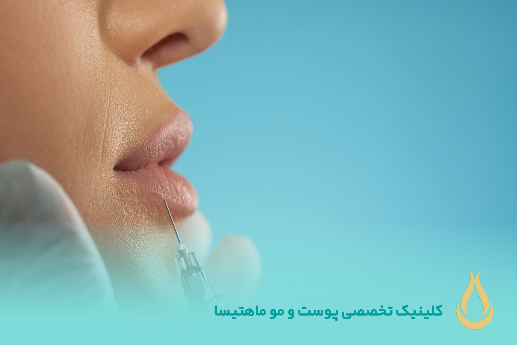 ژل لب