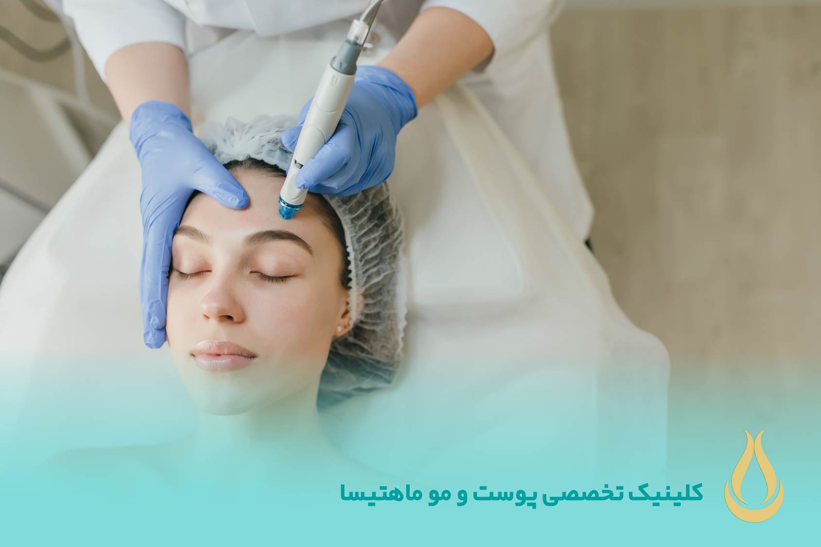 میکرونیدلینگ
